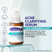 NEW Celeteque Advanced Acne Care Bundle (NEW Celeteque Acne Solutions Acne Clarifying Serum 30ml + Acne Solutions Acne Clearing Facial Moisturizer Gel 50ml)
