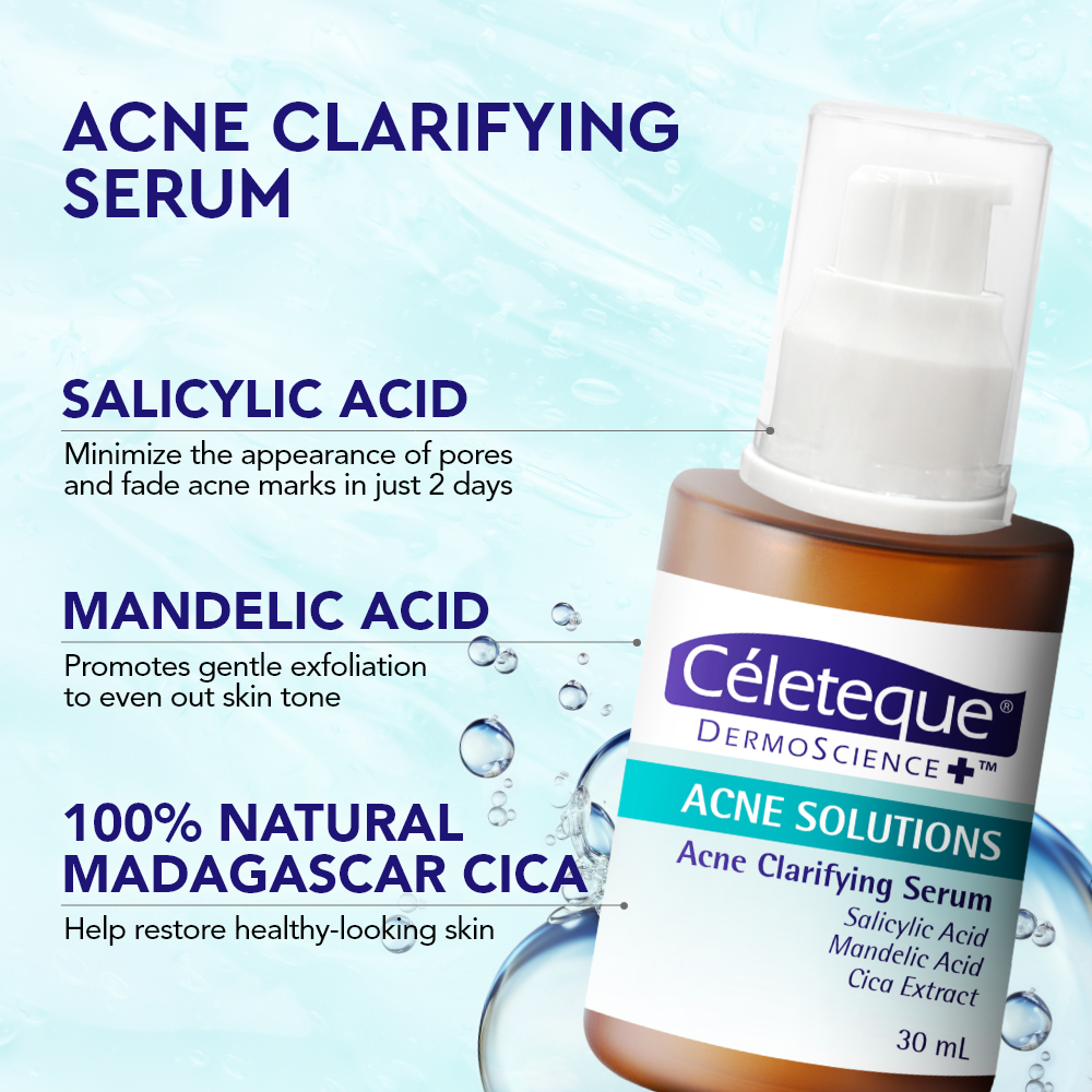 NEW Celeteque Advanced Acne Care Bundle (NEW Celeteque Acne Solutions Acne Clarifying Serum 30ml + Acne Solutions Acne Clearing Facial Moisturizer Gel 50ml)
