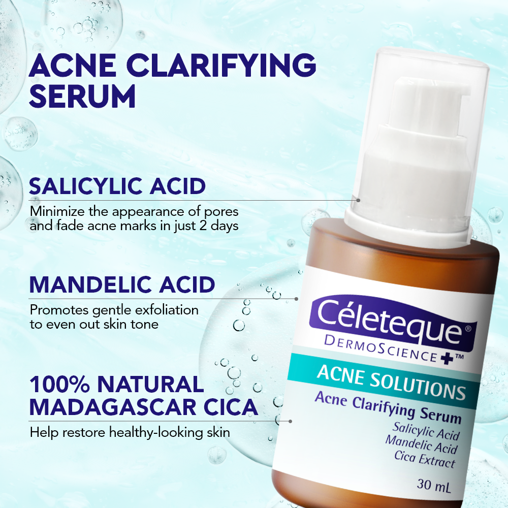 NEW Celeteque Acne Solutions Acne Clarifying Serum 30ml